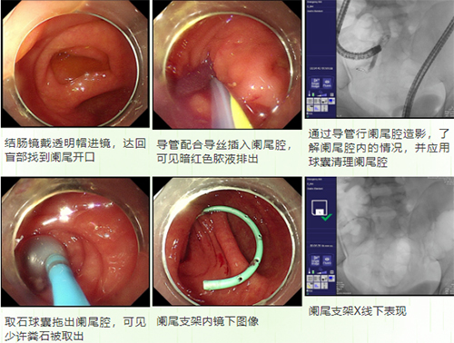未标题-2.jpg 未标题-2.jpg